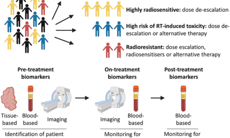 Precision in Oncology: Understanding Radiation Therapy Diagnosis and Staging