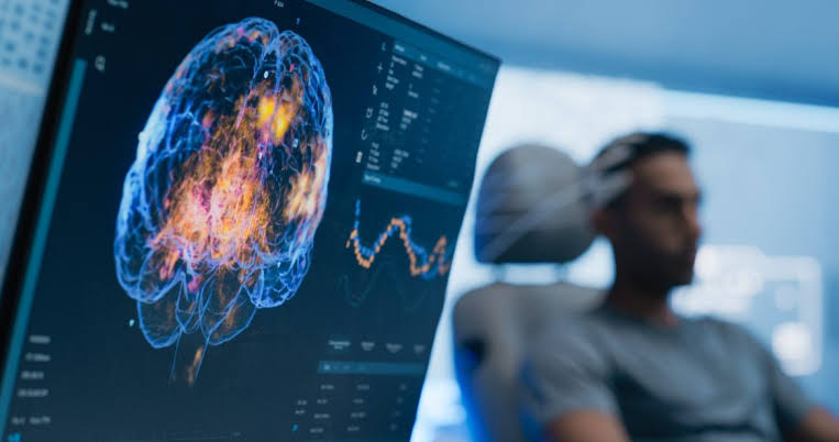 Why Neuromodulation Is Becoming Part of Personal Health Technology