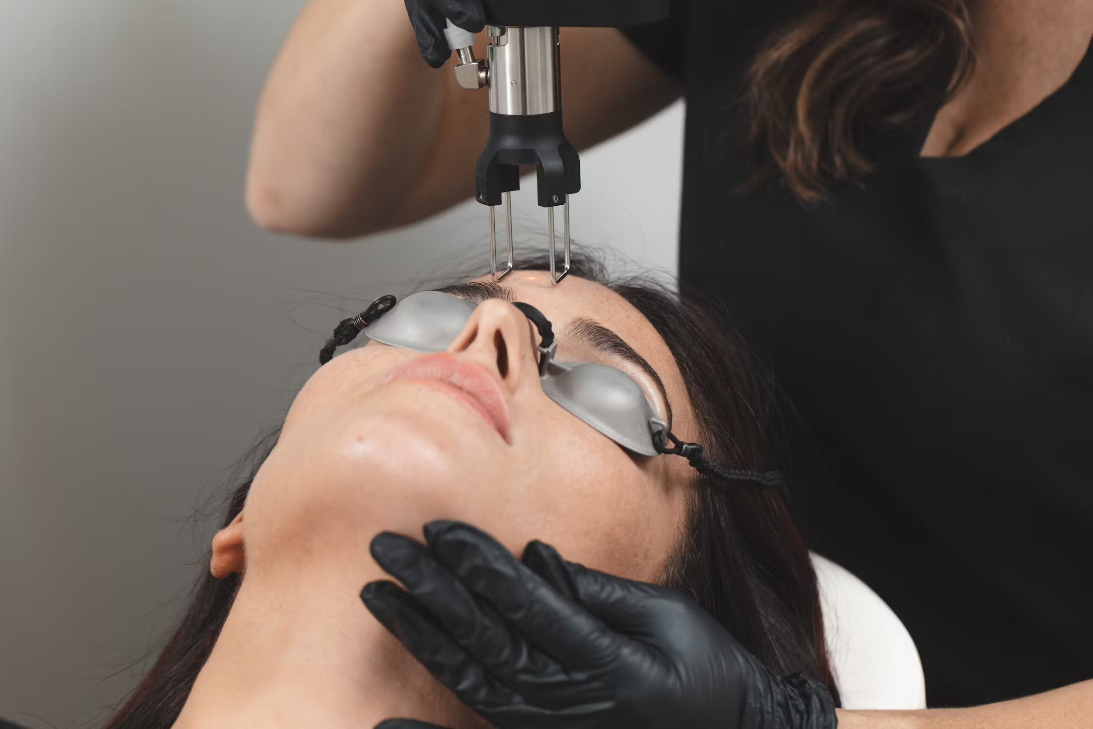 Refresh Your Skin with Cool Peel Stratham, NH – About Face Medical Aesthetics