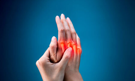 Rheumatoid Arthritis Columbus