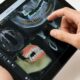 AI Full Mouth Dental Implants