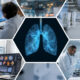 5 HealthTech Startups Developing Hepatology Solutions