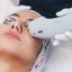 Understanding Spider Vein Removal: A Comprehensive Guide