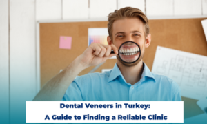 Dental Veneers