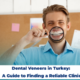 Dental Veneers
