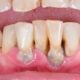 Disease Damages
