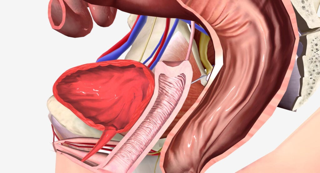 Prostate Artery Embolization in Colorado