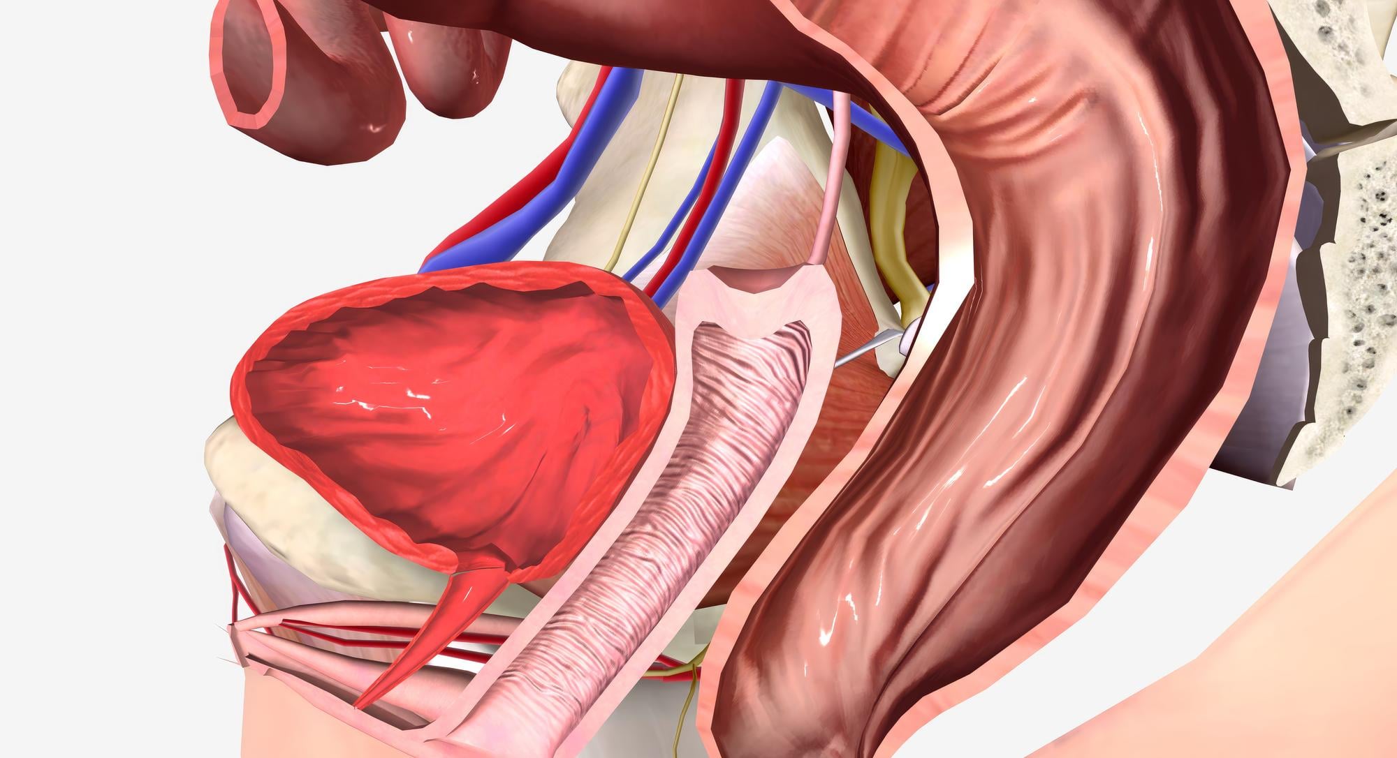 Prostate Artery Embolization in Colorado