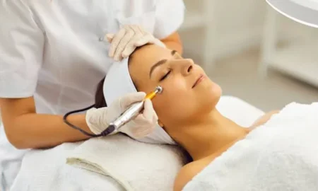 Pelleve Skin Tightening Treatment
