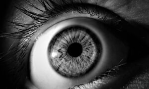 Cataract Care