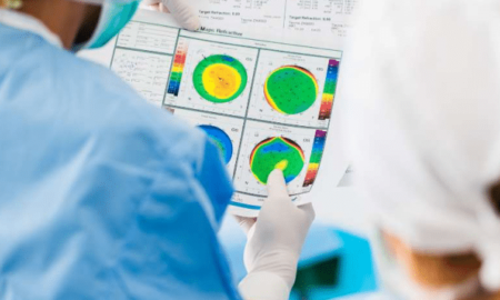 Laser LASIK Eye Surgery Explained, Plus What Your Eye Surgeon Actually Does for You